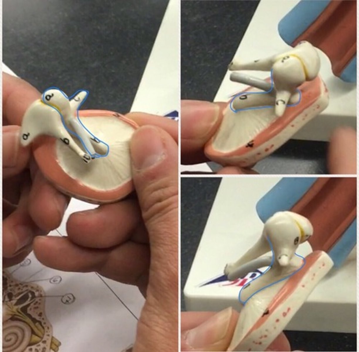 <p>a small bone in the middle ear that transmits vibrations of the eardrum to the incus. Connects to the tympanic membrane</p>