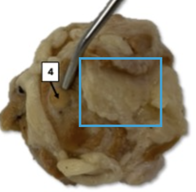 <p>What is this highlighted figure?</p>