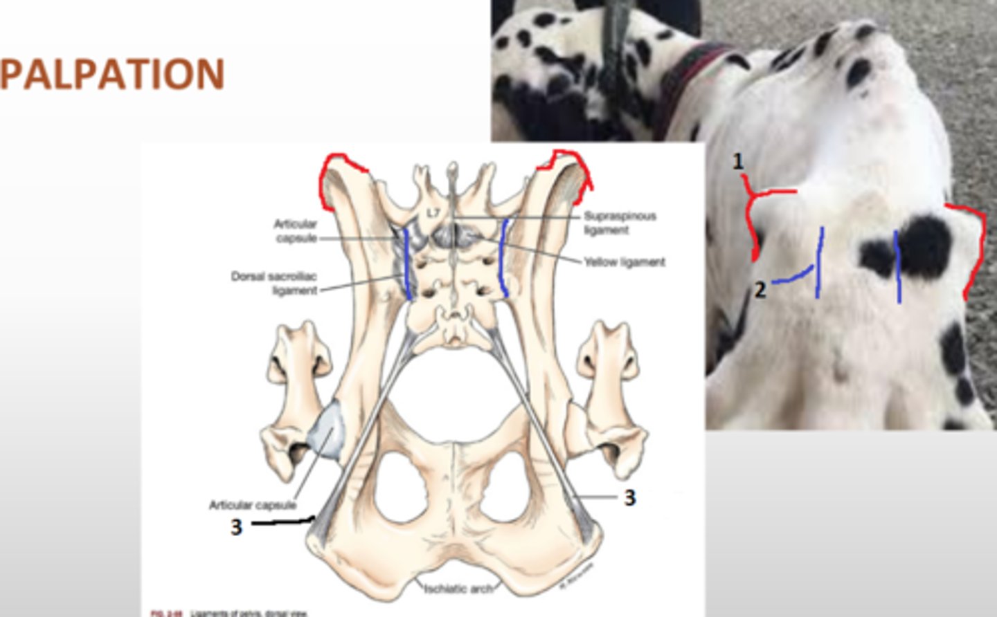 <p>point of hip, wing of ilium</p>
