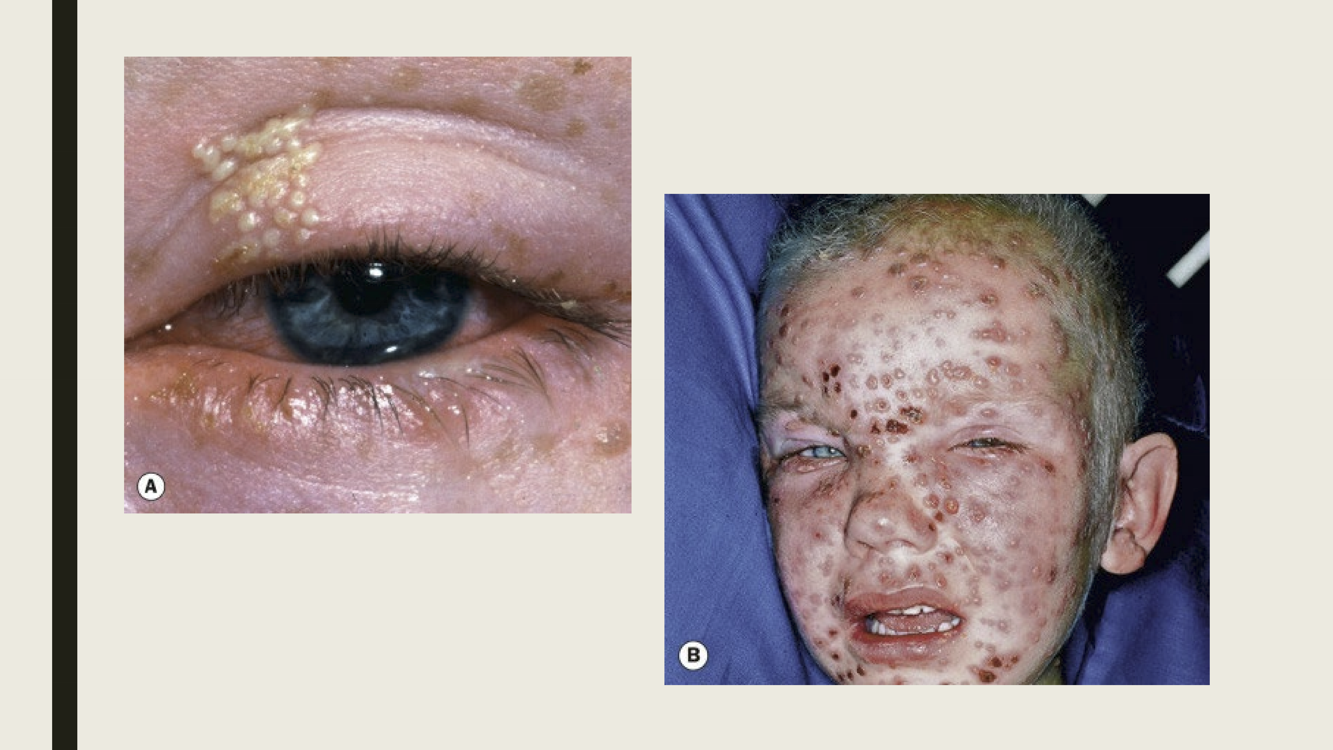 <p>Oral medications or topical cream </p>
