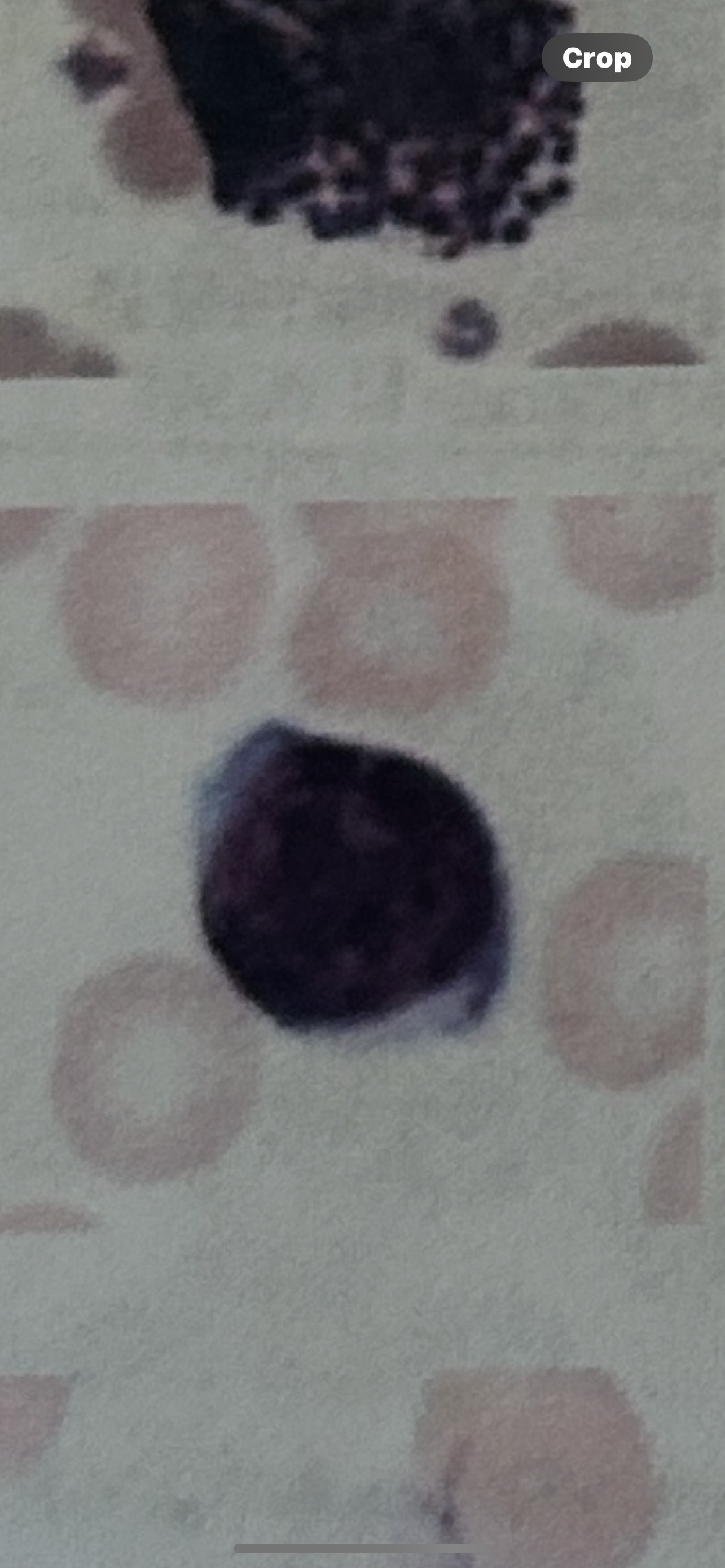 <p>WBC</p>