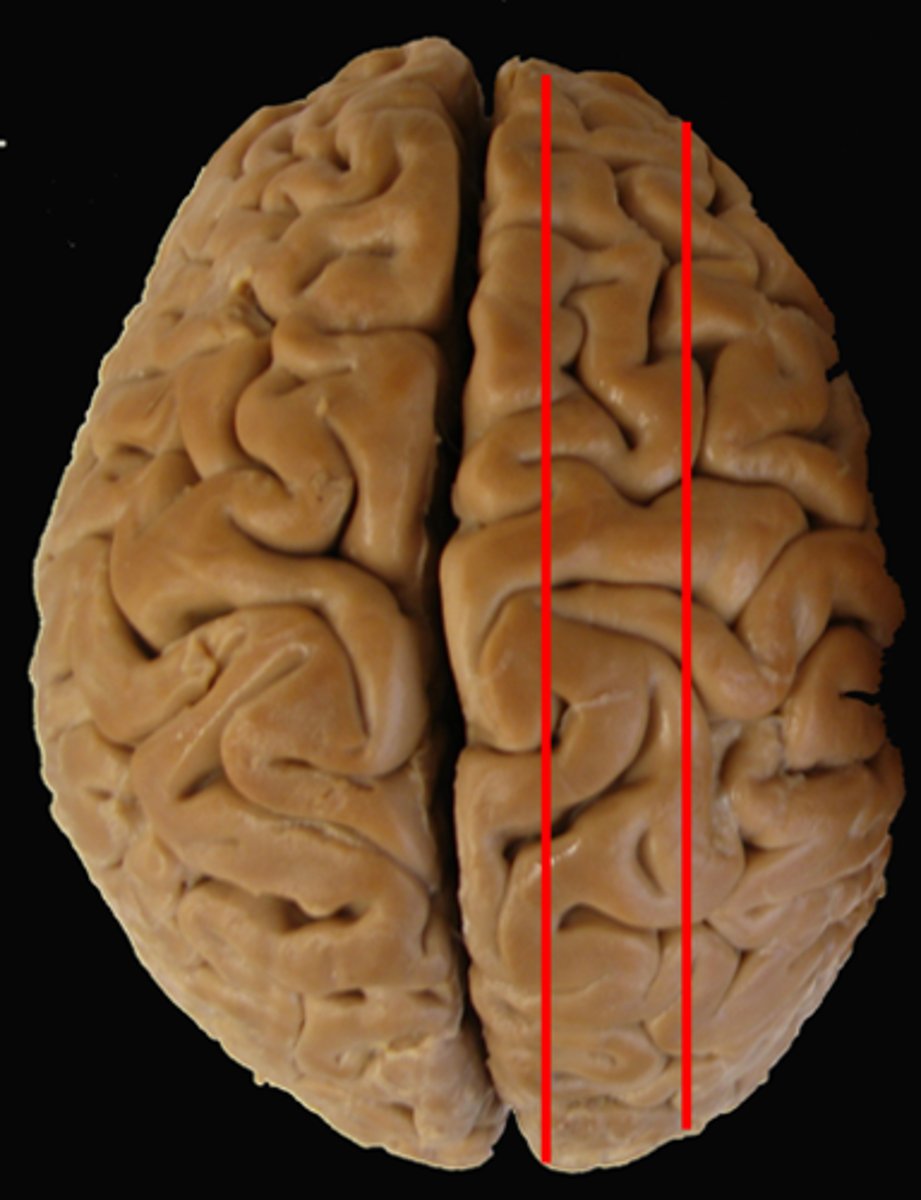 <p>not on midline - divides left to right</p>