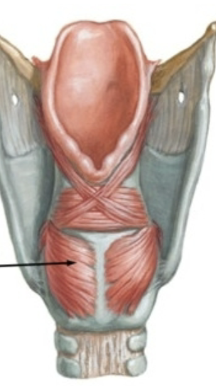 <p>What is this muscle?</p>