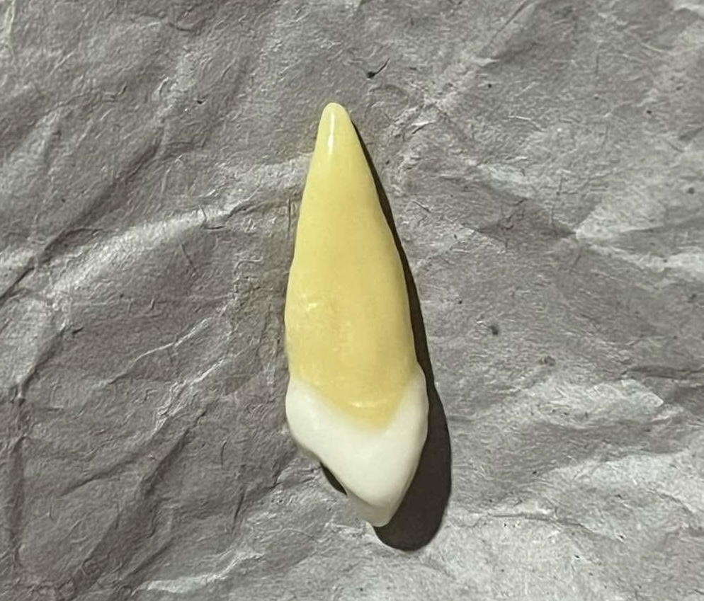 <p>What tooth is this (with view)?</p>