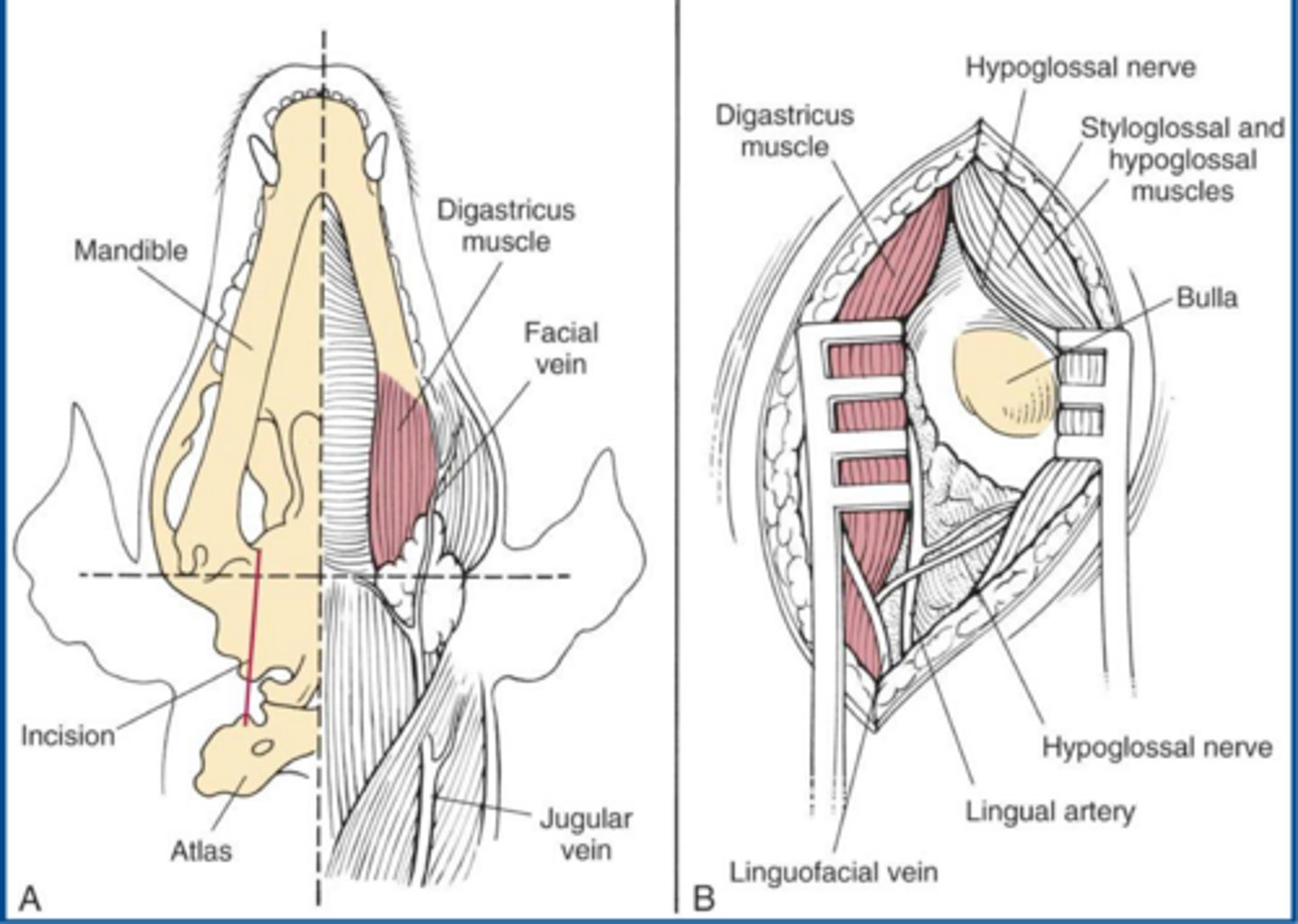 <p>significance of a ventral bulla osteotomy</p>
