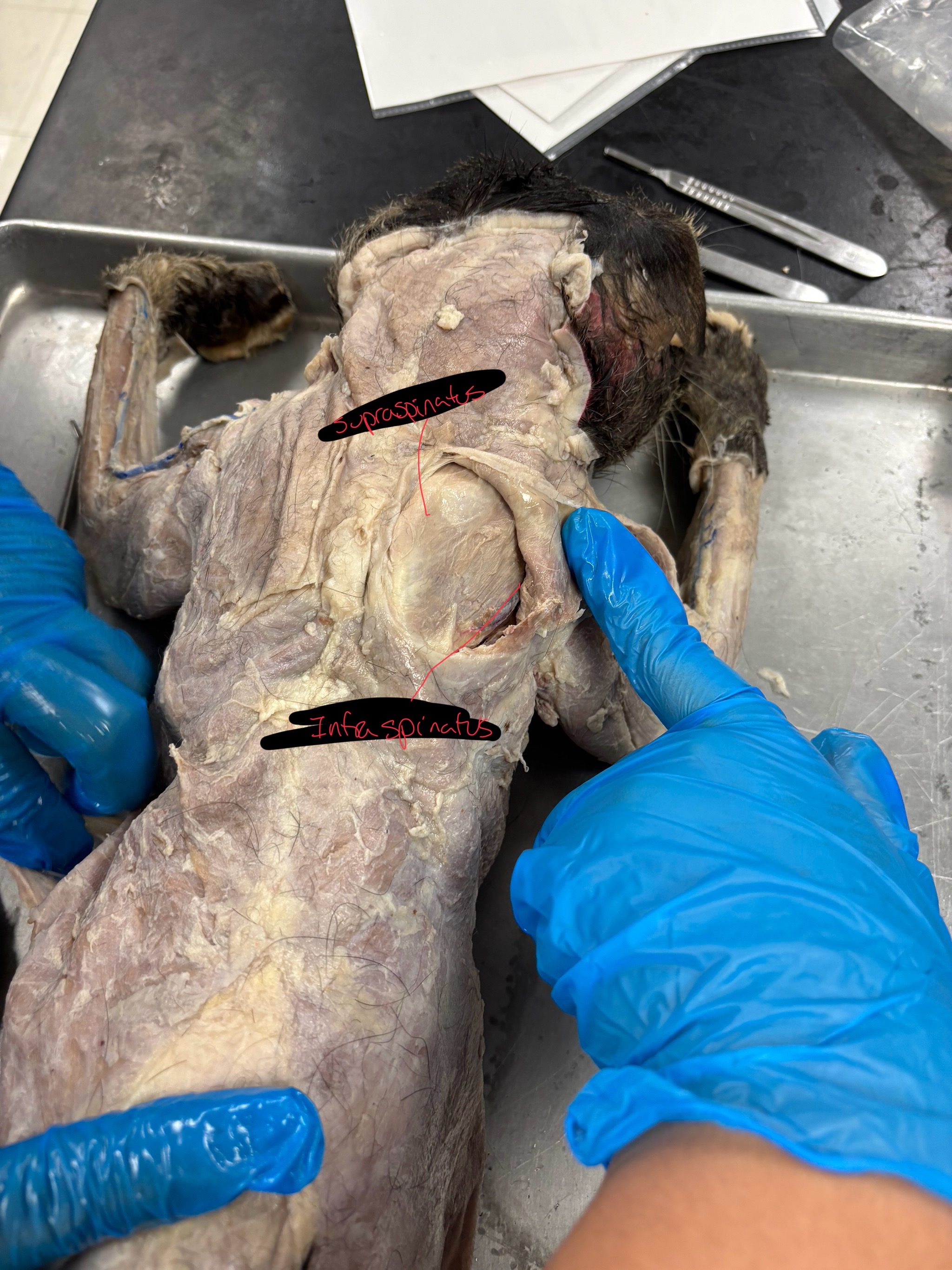 <p>supraspinatus: protracts the arm at shoulder (pulls shoulder forward)</p><p>Infraspinatus: Rotates the arm laterally at shoulder</p>