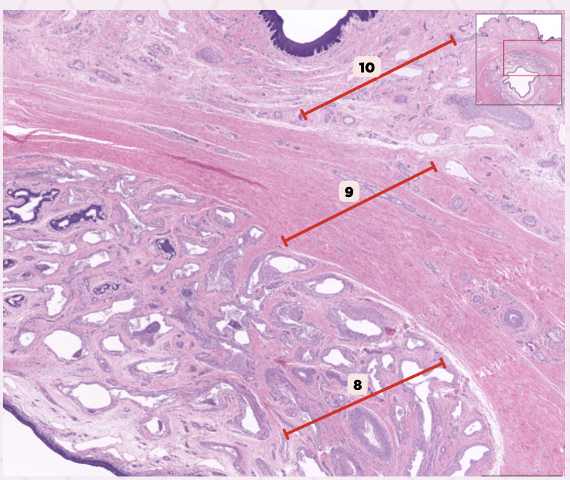 <p>Identify the structure labeled as 10.</p>