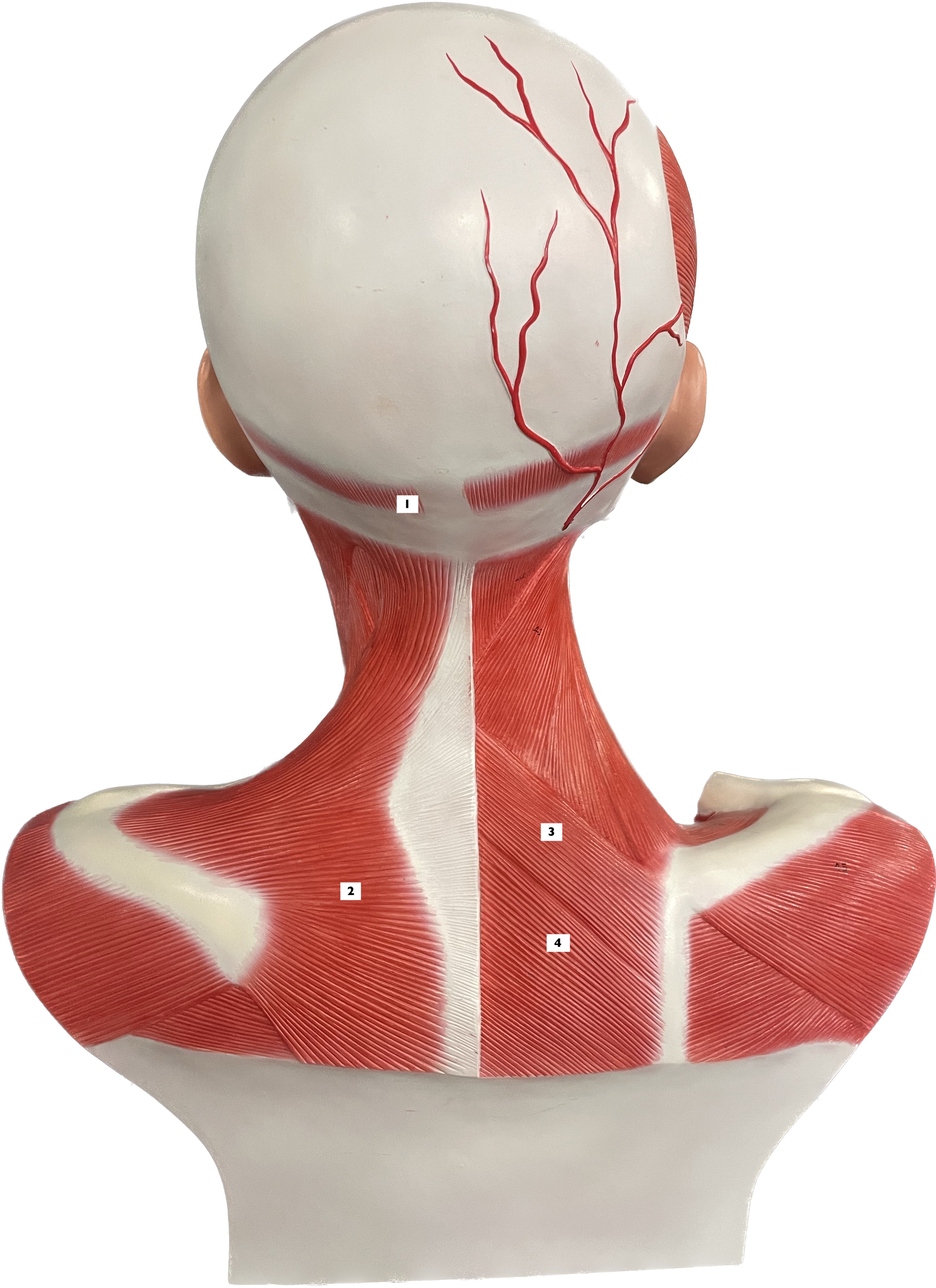 rhomboids - adducts scapula