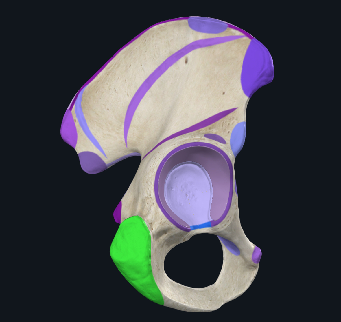term image