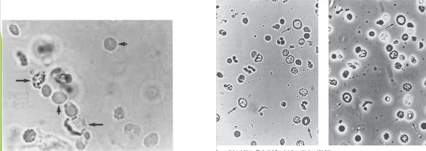 <p><span>Ideal for urine sediments; allows more detailed visualization of translucent or low-refractile components and living cells</span></p>
