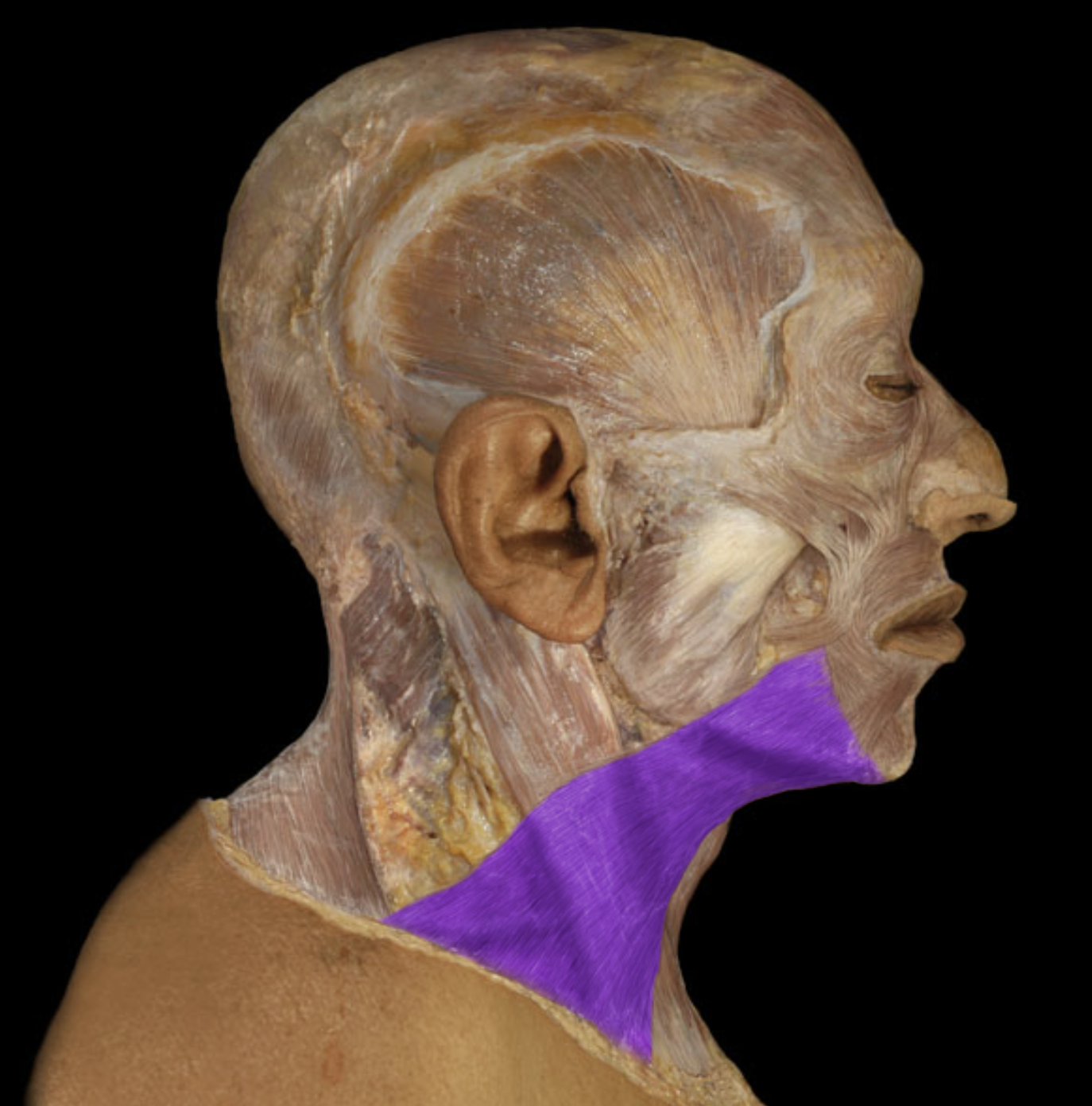 <p>What muscle is this?</p>
