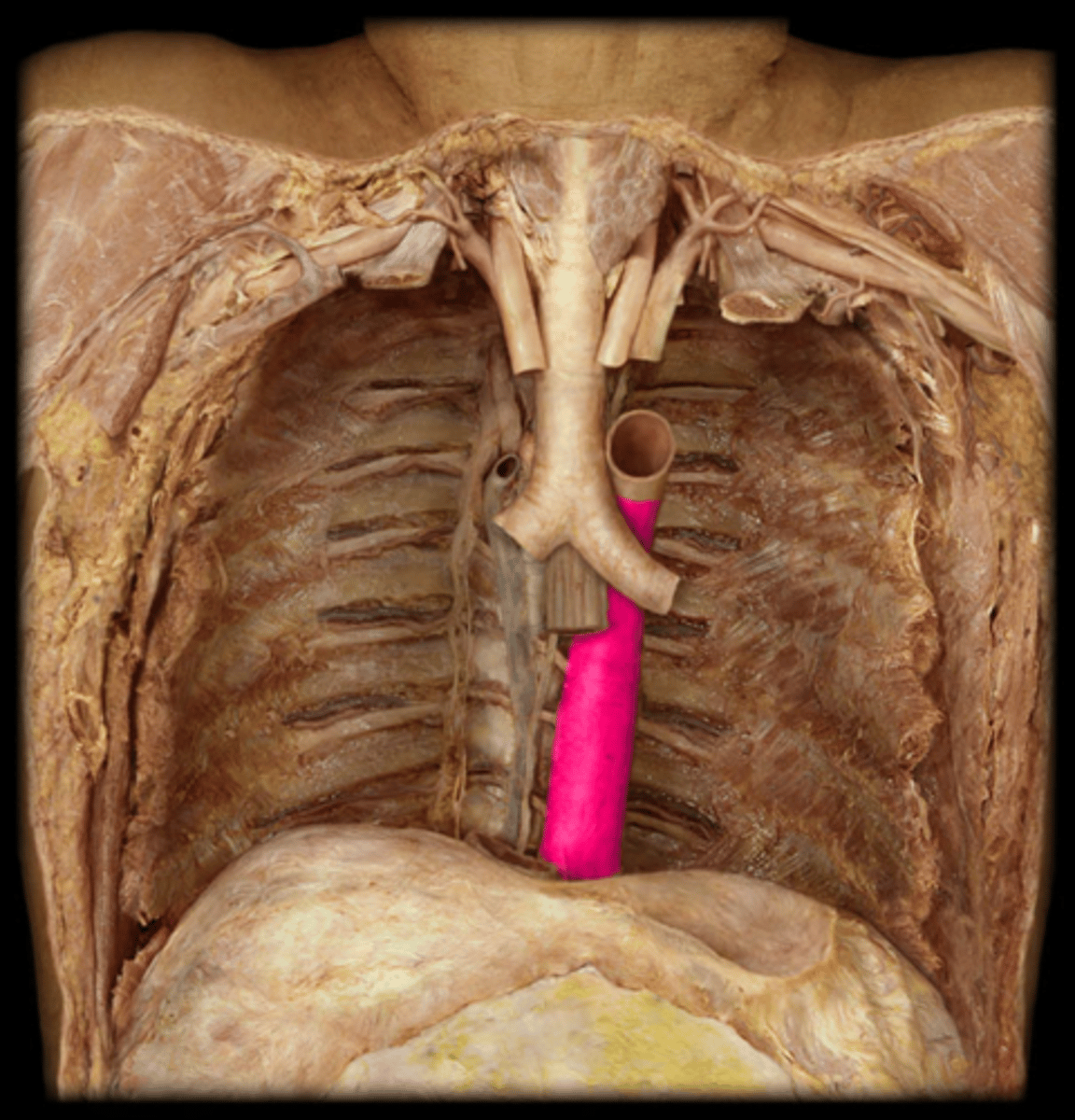 <p>Area supplied: Thoracic cavity</p><p>Terminal branch: Abdominal aorta</p><p>Relationship: Located on the left side of the posterior mediastinum in the thoracic cavity</p>