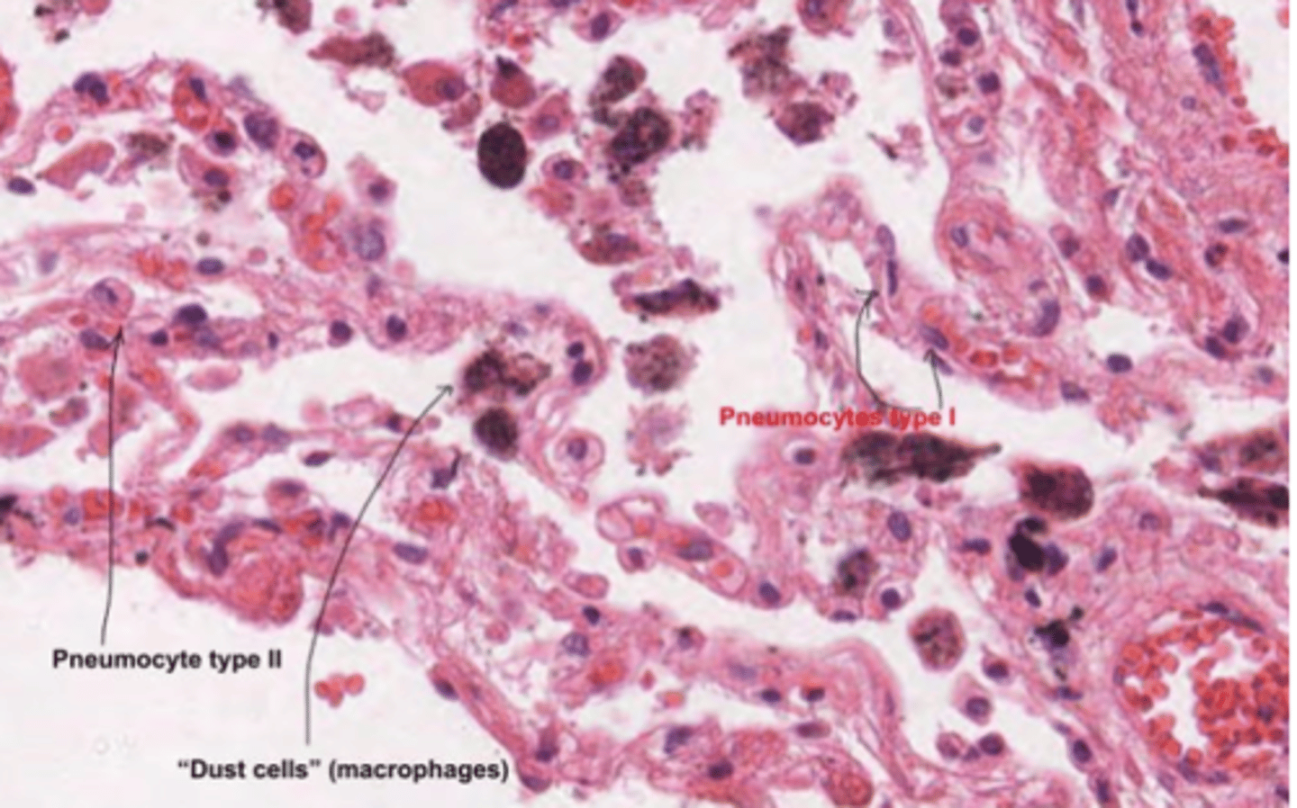 <p>type I: flat cell, little cytoplasm. Recovering most of the alveolus</p><p>type II: round, bigger cell, more cytoplasm.</p>