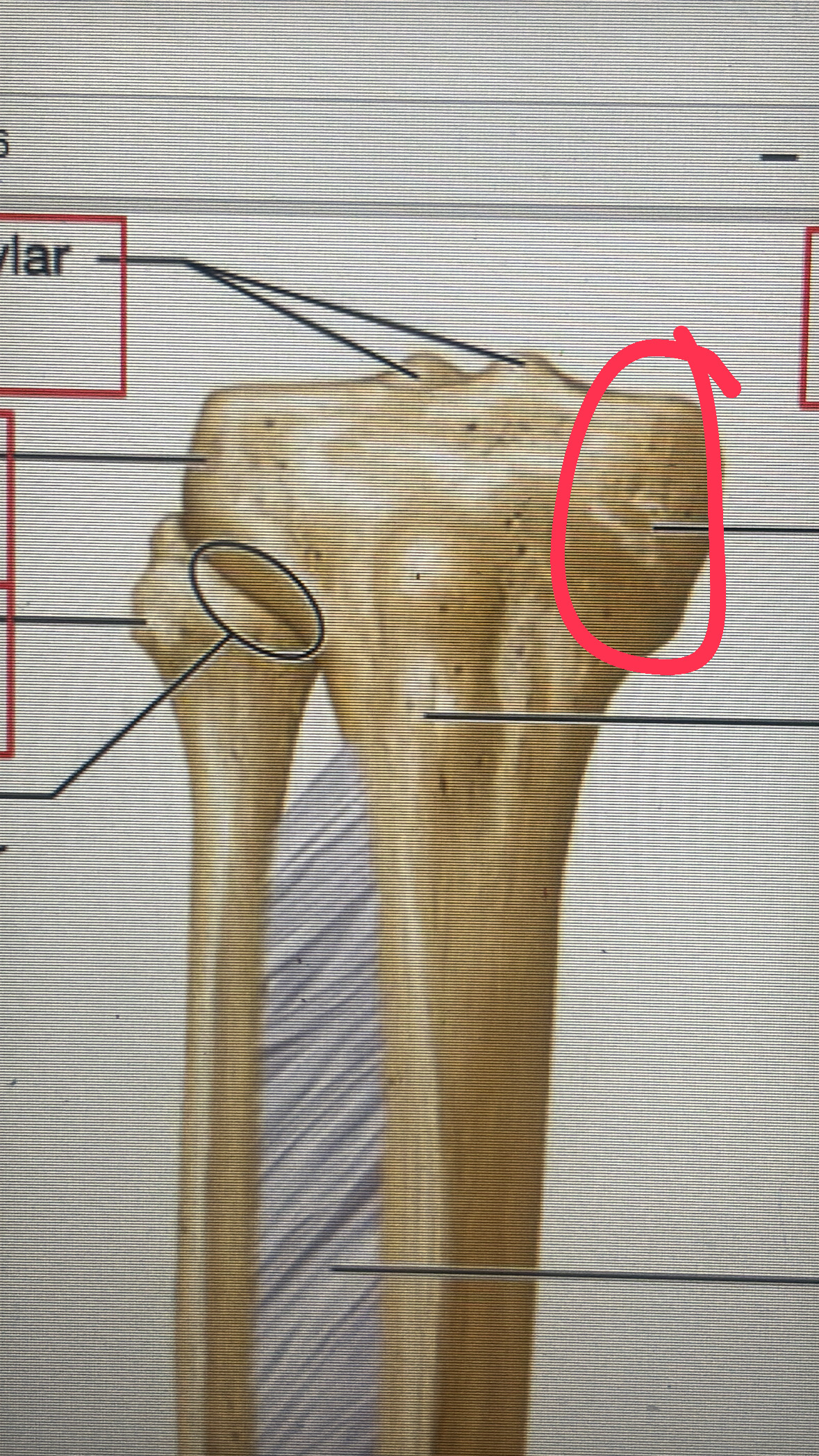 <p>inner bulb of the proximal epiphysis of the tibia</p>