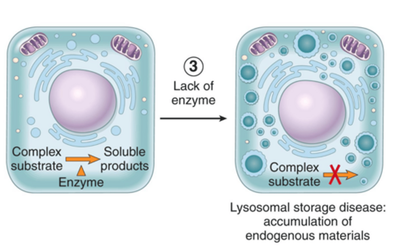 <p>Defects in lysosomal function due to missing enzymes, typically inherited as autosomal recessive disorders.</p>