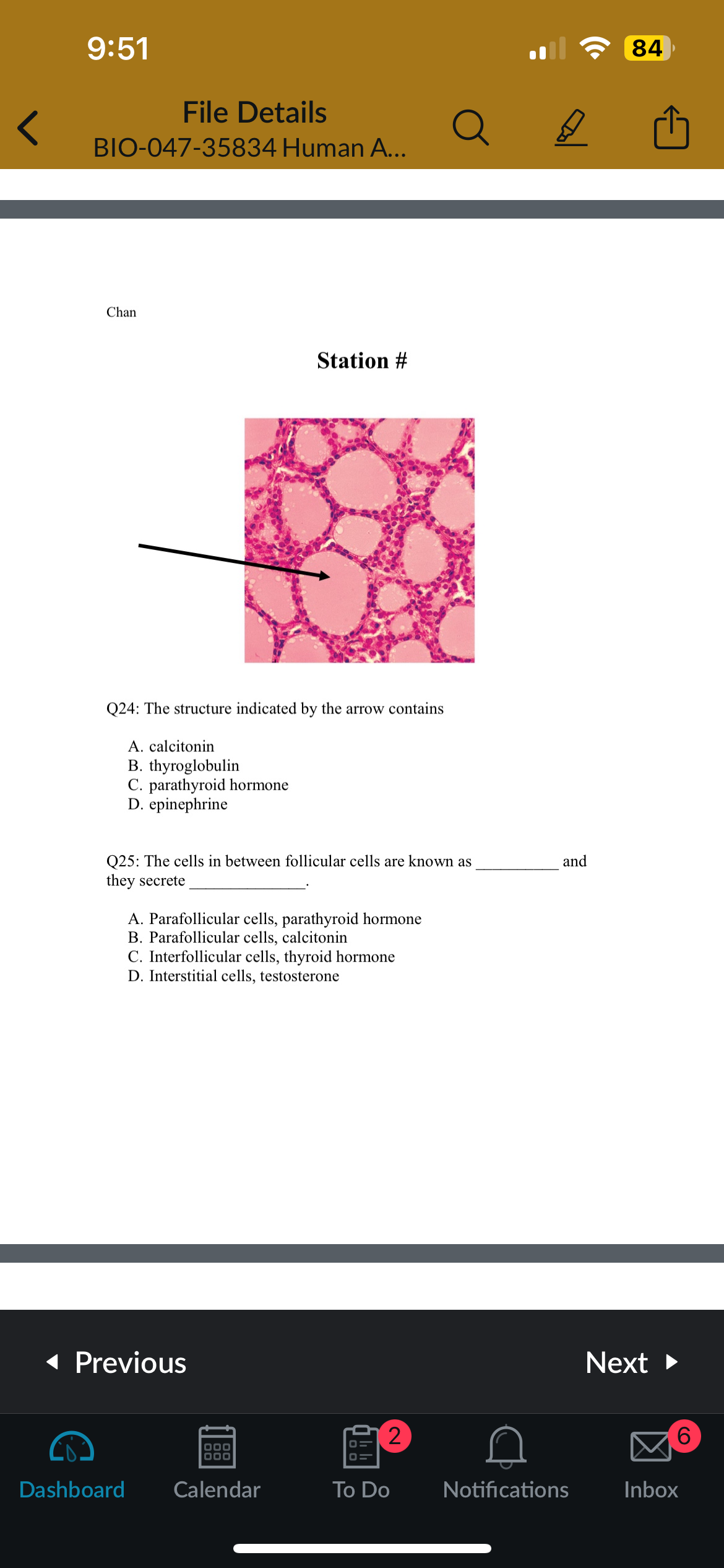 <p>Q24: The structure indicated by the arrow contains</p>