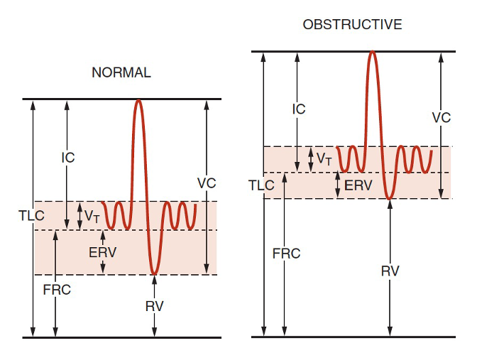 <p>Normal or ↑</p>