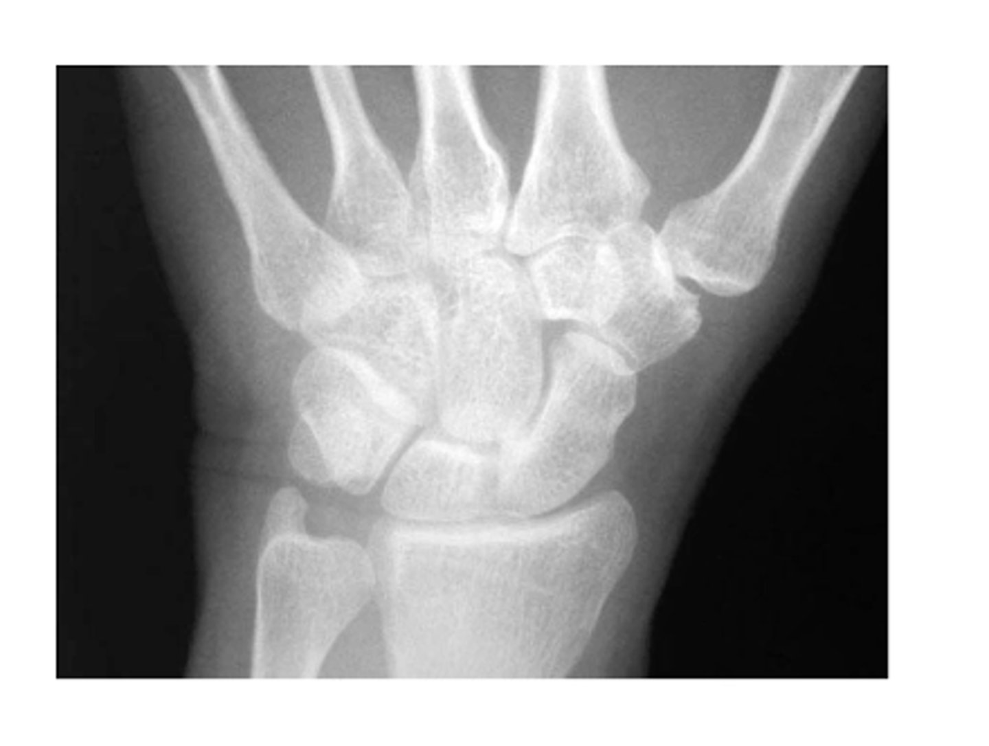 <p>State the type of view and structure being depicted.</p>