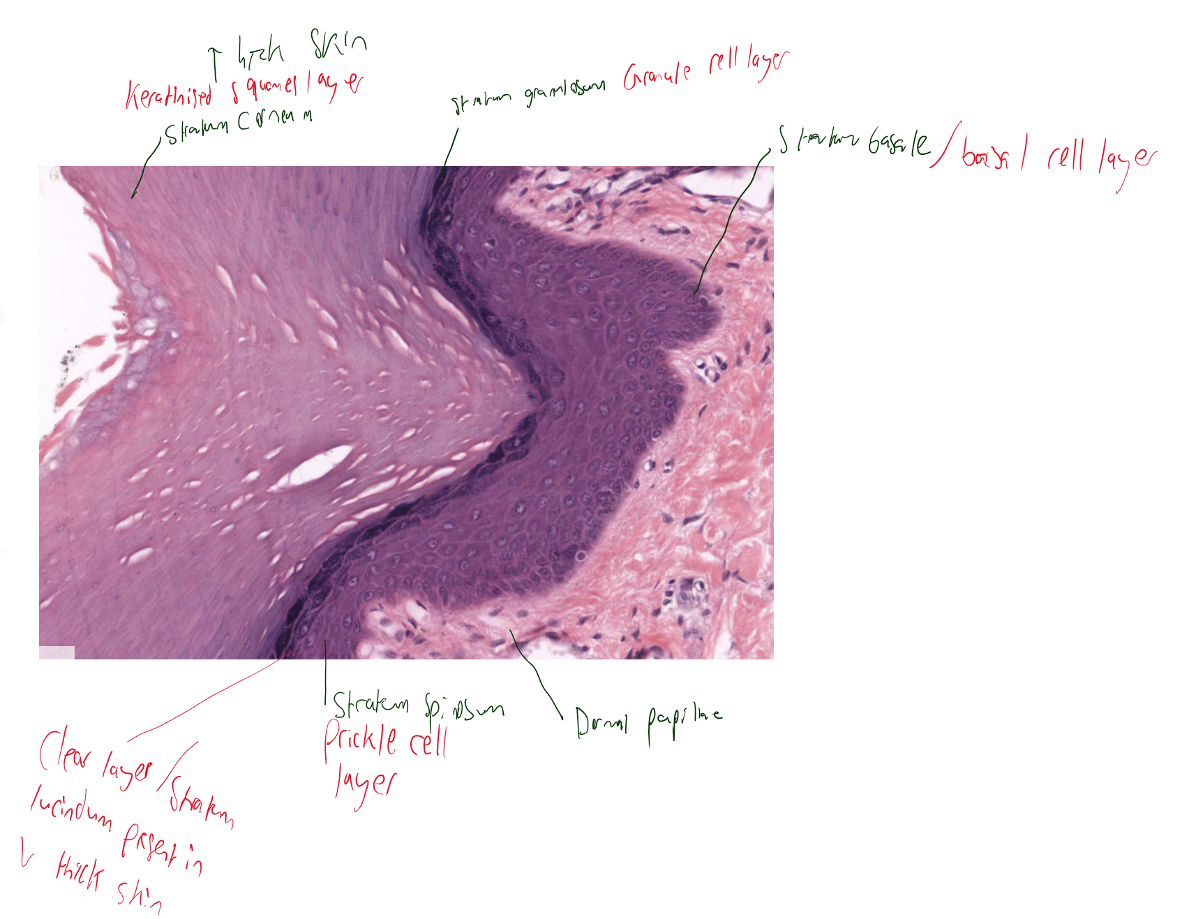<p>basal cell layer</p><p>prickle cell layer</p><p>granule cell layer</p><p>clear layer- only thick skin</p><p>keratinised squames layer- thicker in thick skin and thinner in thin skin. </p>