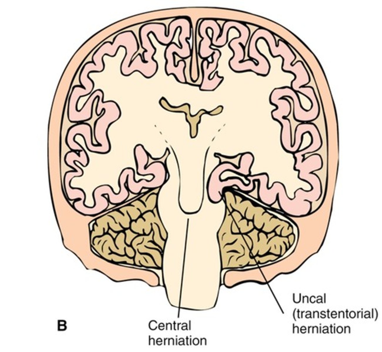 <p>Indicates adequacy of oxygen delivery to the brain.</p>