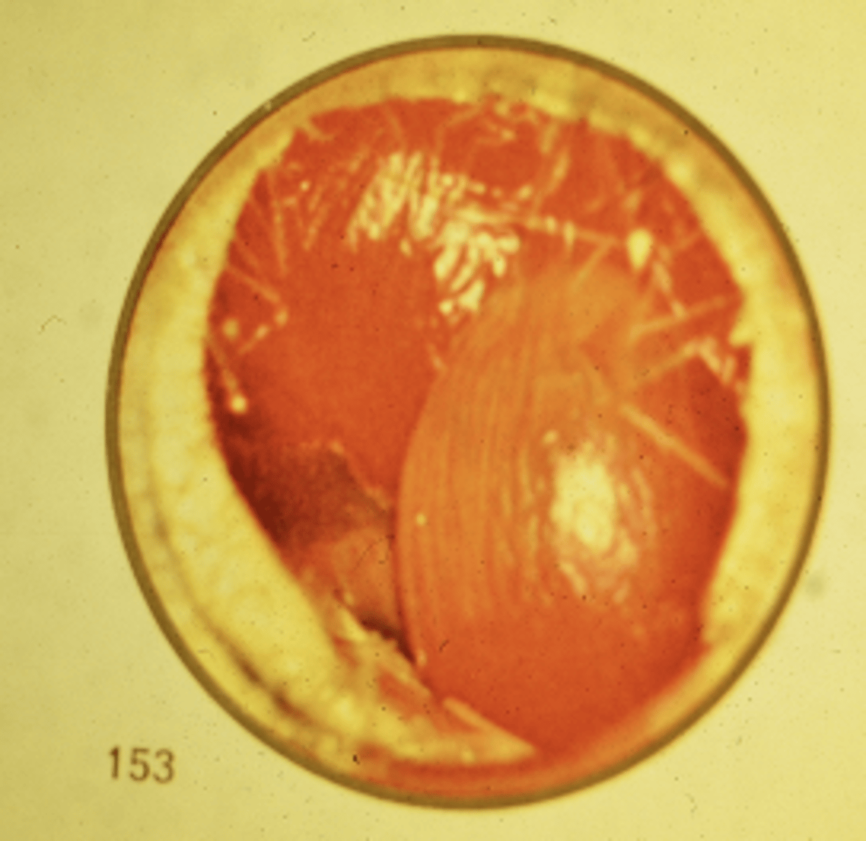 <p>What does the image indicate?</p>