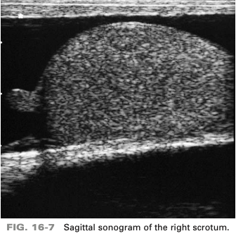 <p>echogenic structure superior to the testes most likely respresents</p>