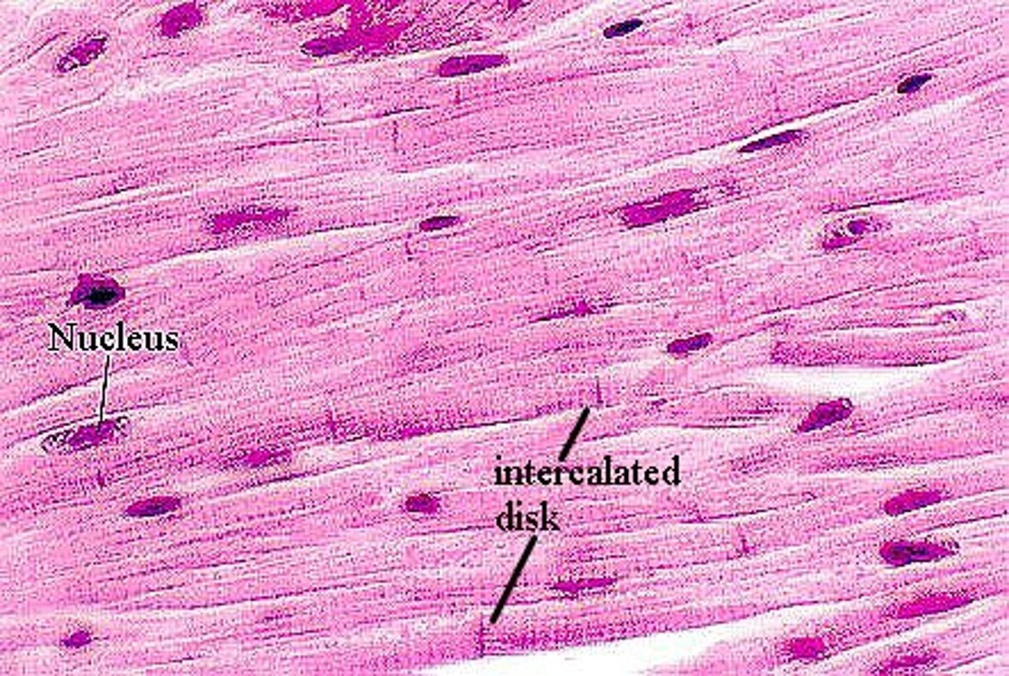 <p>what tissue is this? *hint, look for intercalated discs*</p>