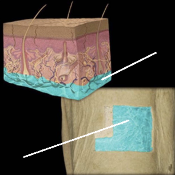 <p>Hypodermis </p>