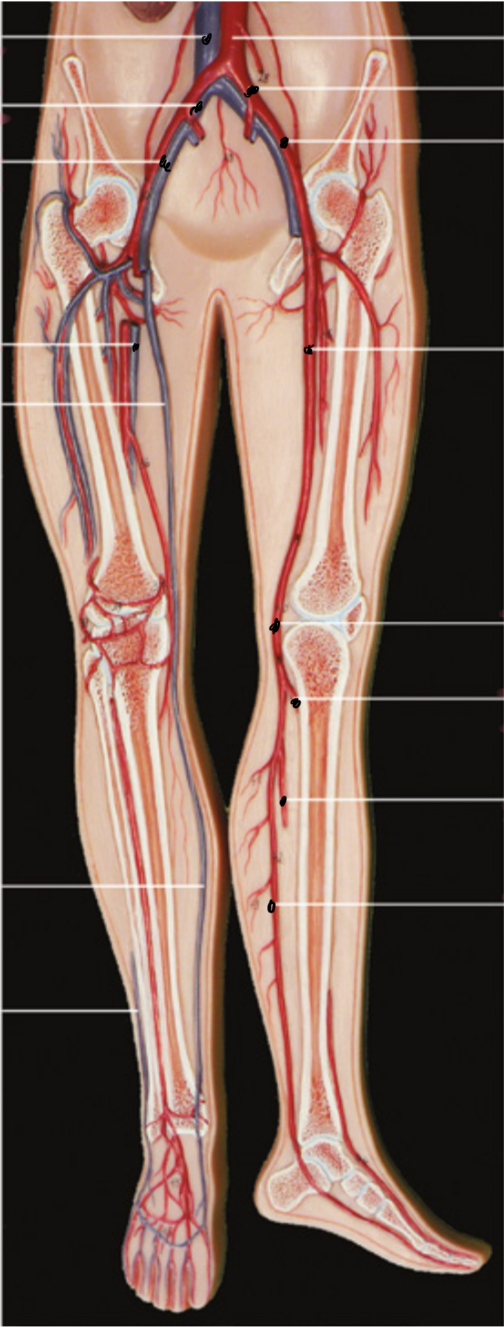 <p>Isvardink kraujagysles</p>