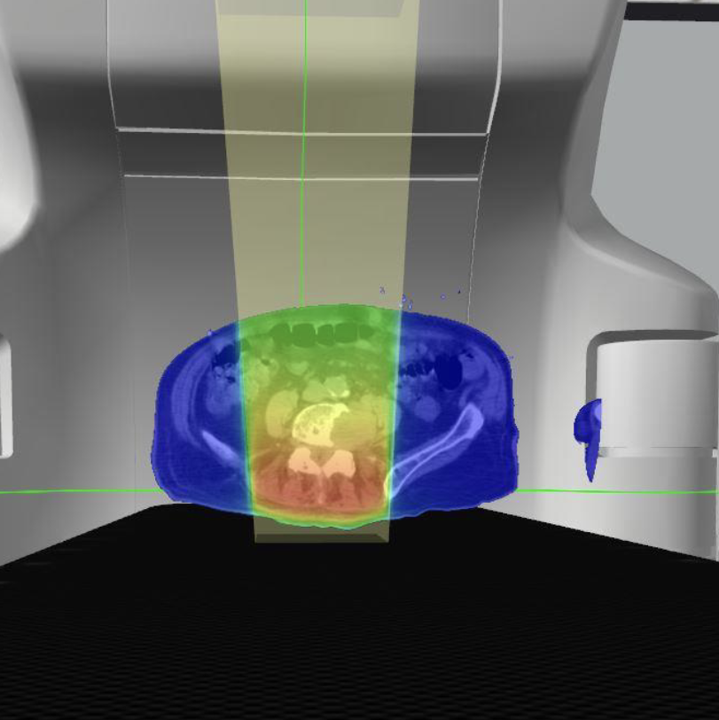 <p>Describe this treatment technique</p>