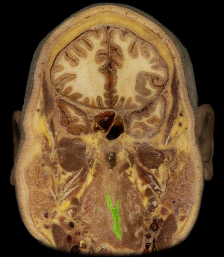 term image