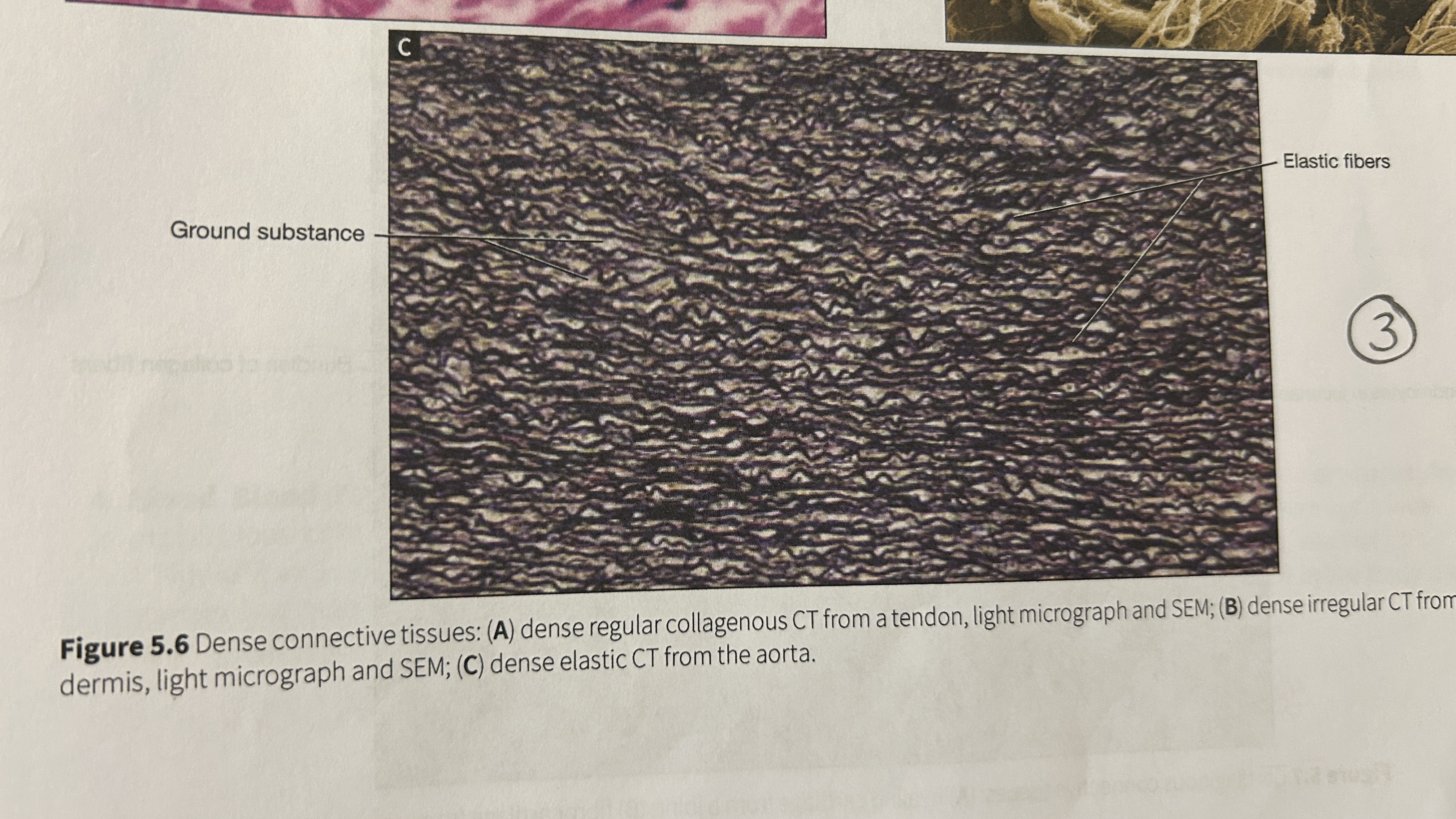 <p>contains elastic fibers arranged in parallel bundles, which are found in organs that need both distensible and elastic like large blood vessels and ligaments, to allow adherence to pressure changes and stretchiness. </p>