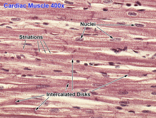 <p>striated, tubular, &amp; branched</p><p>single nucleus</p><p>contract involuntarily</p><p>walls of heart (only)</p>