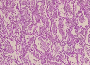 <p>What is the histology?</p>