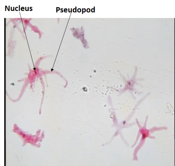 <p>Uses Pseudopod for movement</p>