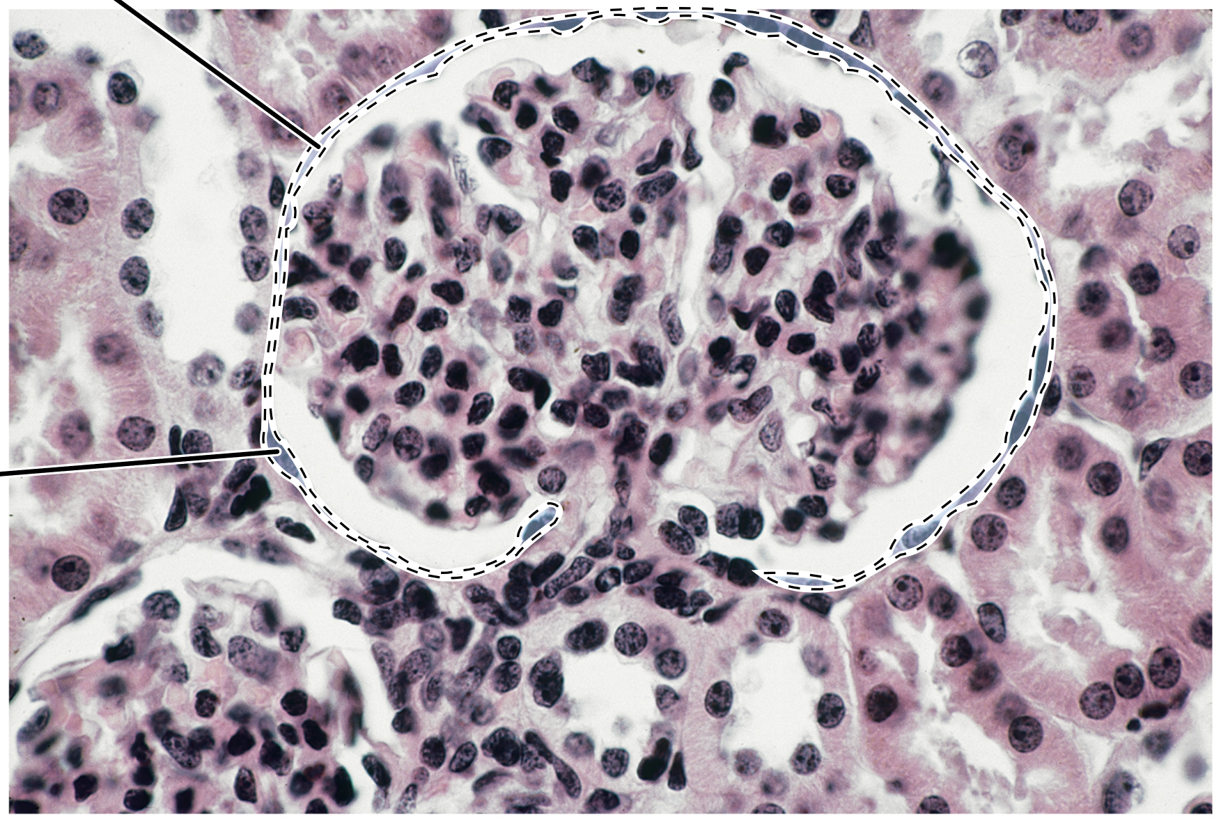 <p>Name the highlighted tissue.</p>