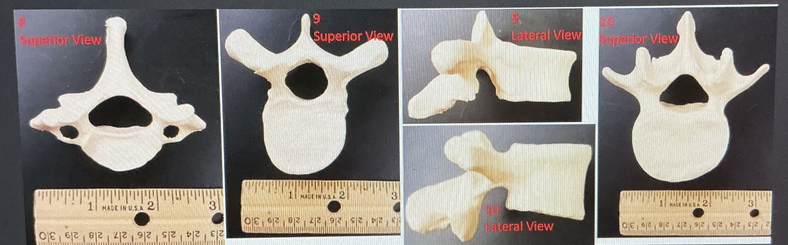 <p>8) of the 5 groups of vertebrae, which group does the vertebrae labeled 8 belong to?</p>