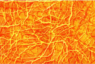 <p><strong>NERVE NET</strong></p>