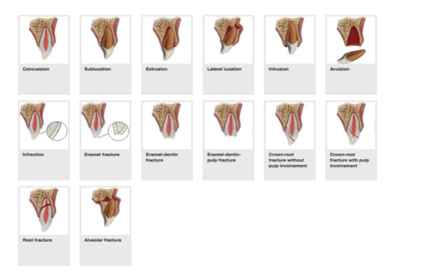 knowt flashcard image