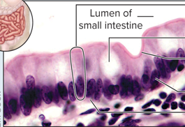 <p>Simple columnar epithelium</p>