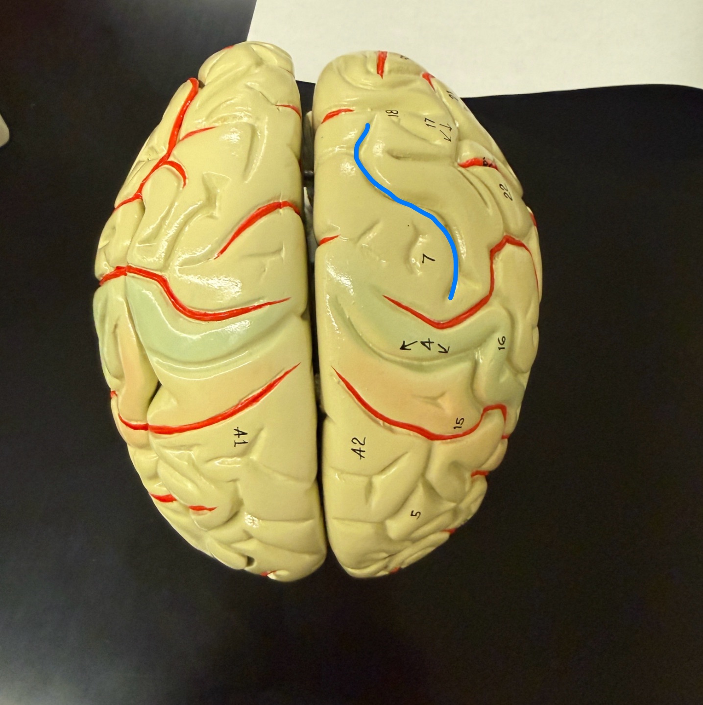 <p>What is outlined in blue on the brain model?</p>