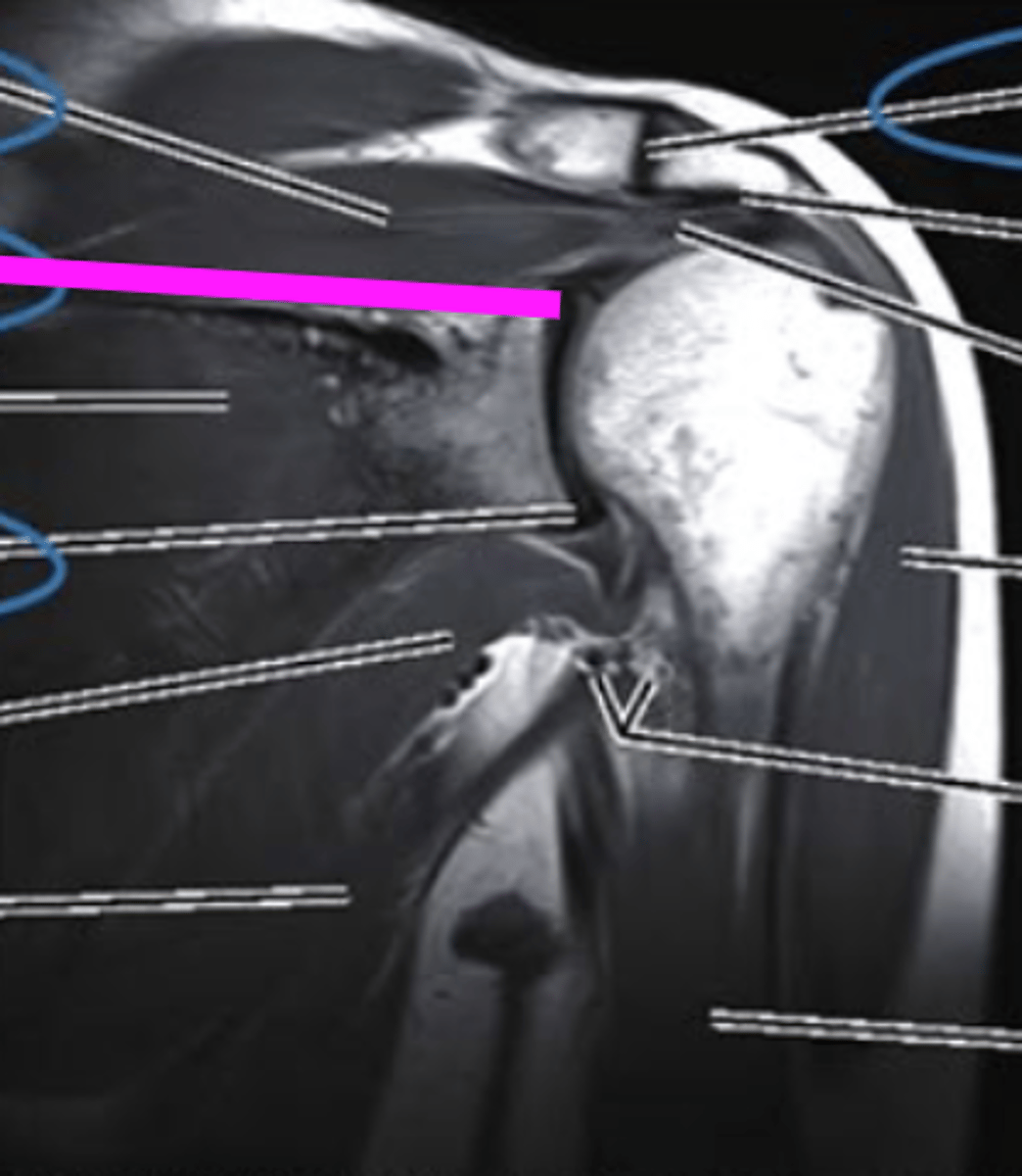 <p>what does the pink line point to?</p>