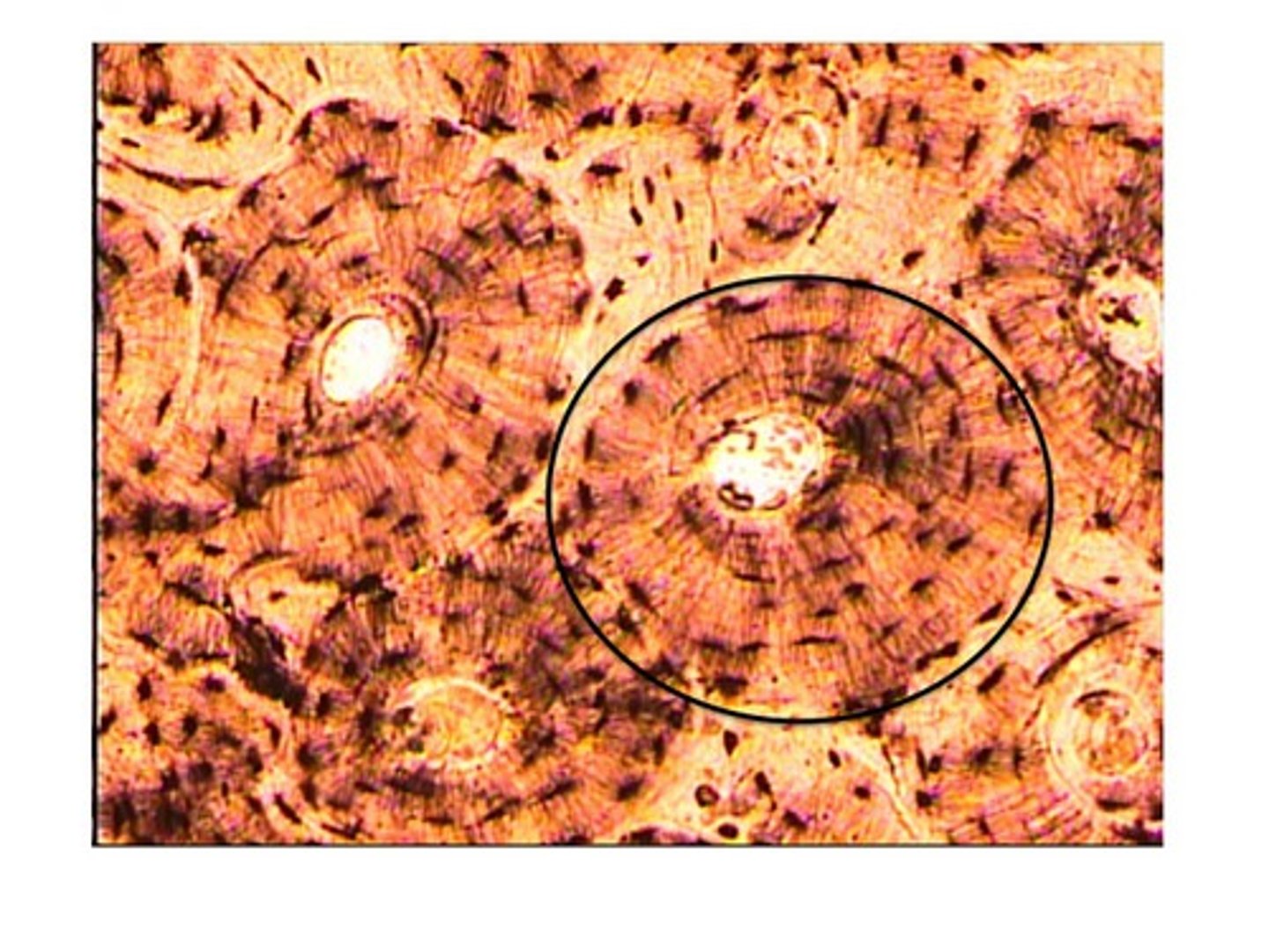 <p>functional unit of compact bone</p>