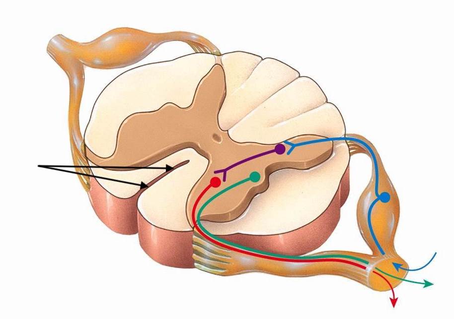 <p>What is this fissure</p>