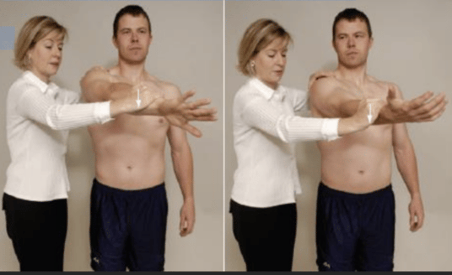 <p>- SLAP (type 2) or superior labral lesions</p><p>(+): If pain on the joint line or painful clicking is produced inside the shoulder (not over the acromioclavicular joint) in the first part of the test and eliminated or decreased in the second part, the test is considered positive for labral abnormalities.</p>