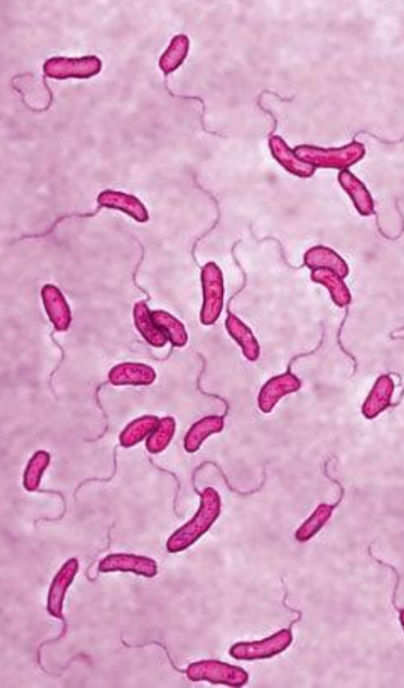 <ul><li><p>gram-negative</p></li><li><p>rod-shaped</p></li><li><p>facultative anaerobic</p></li><li><p>with polar flagella</p></li></ul><p></p>