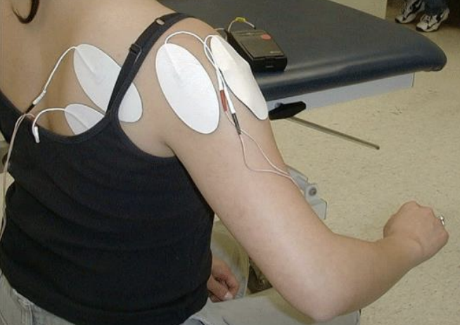 <p>ES <strong><u>reduces the severity of glenohumeral subluxation</u></strong>, but there was <strong><u>no significant effect on upper limb motor recovery or upper limb spasticity</u></strong></p><ul><li><p><strong><u>potentially good for prepping before a session&nbsp;</u></strong></p></li></ul><p></p>