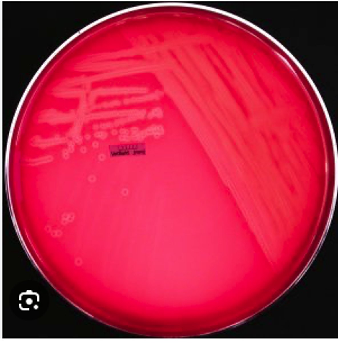 <p>This pathogen was isolated from the brain stem of a cow with unilateral neurological signs. Presumptive diagnosis was "circling disease". A selective broth enrichment culture technique was used to isolate the pathogen provided. This organism is catalase-positive and CAMP-positive.</p><p>Examine the 24 hr BA agar culture. Describe the colony morphology. Is hemolysis present?</p>