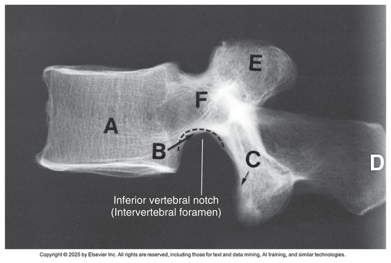 <p>What anatomical structure is letter E?</p>