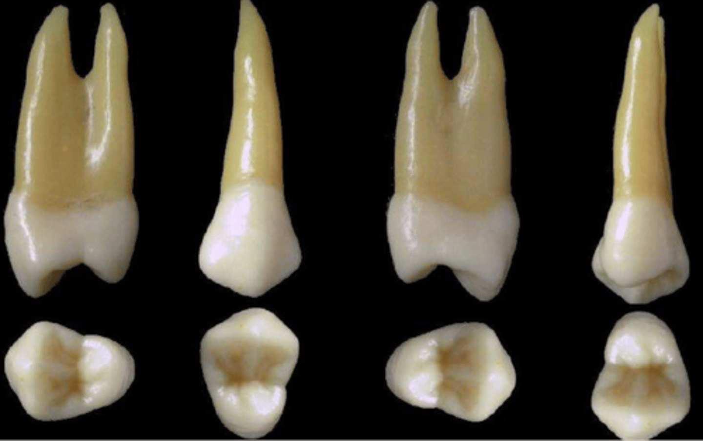 <p>what tooth is this &amp; why?</p>
